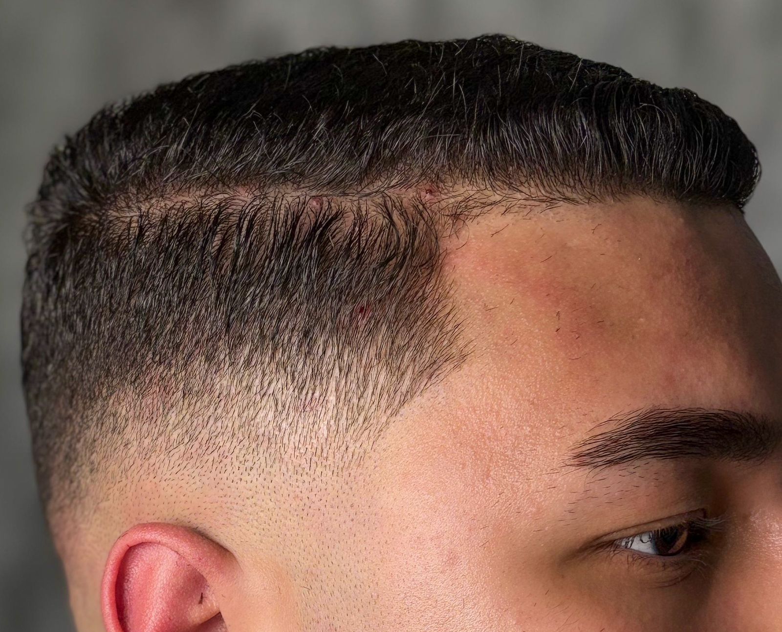 Degradê Lateral Preciso